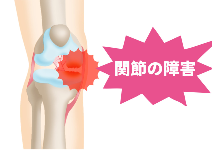 膝　関節　障害